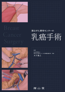 国立がん研究センターの乳癌手術
