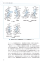 肺動脈形成術PTPABPA実践ガイド
