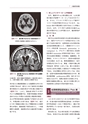 臨床神経内科学　改訂6版