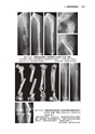骨折・脱臼　改訂４版